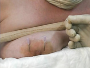 Nipple piercing with needle